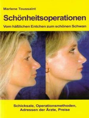 cover image of Schönheitsoperationen -Vom hässlichen Entchen zum schönen Schwan